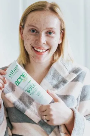 How to Get Rid of Acne [Alba Botanica&reg; Acnedote&trade; Review]