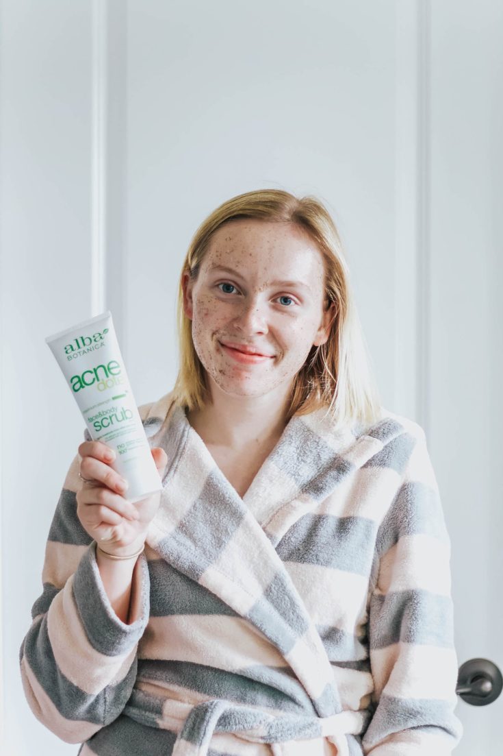 How to Get Rid of Acne | Alba Botanica® Acnedote™ Review - Holly Habeck